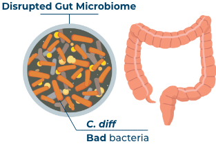 Disrupted Gut Microbiome