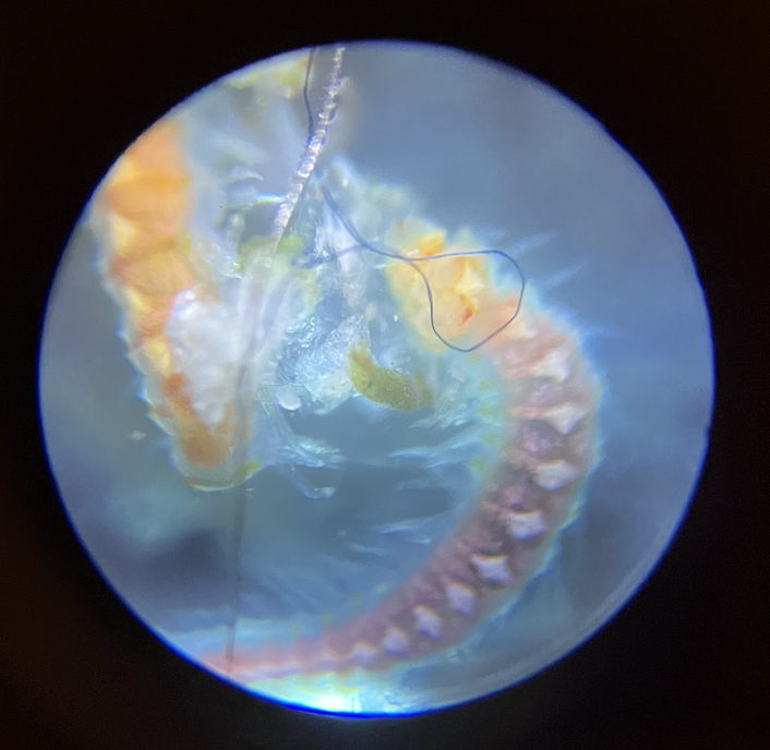 Microscope picture of worms | Reef2Reef