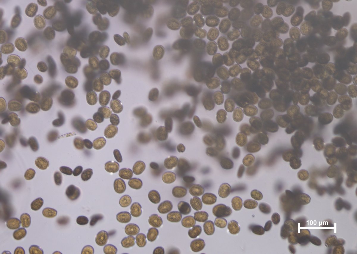 What is this algae and how do i get rid of it? | Reef2Reef