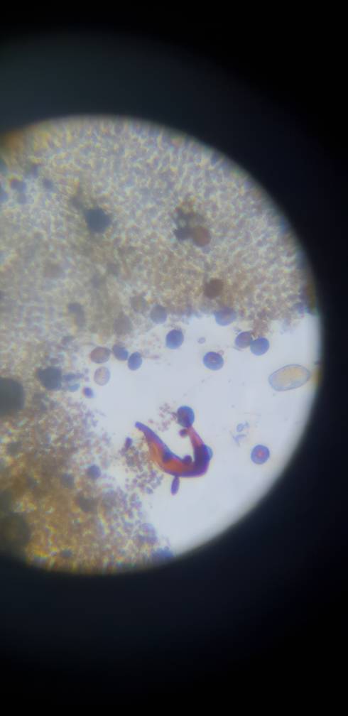20181101_212617.jpeg