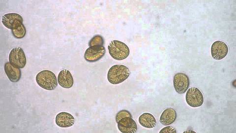 Amiphidium_Dinoflagellate_large.jpg
