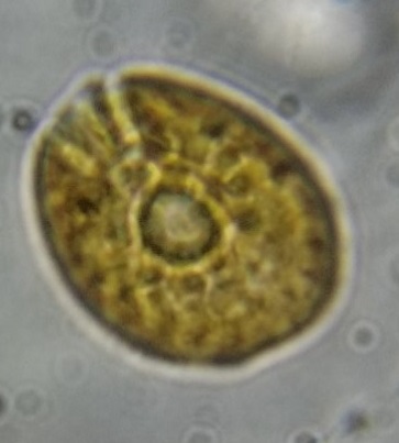 amphidinium1.jpg