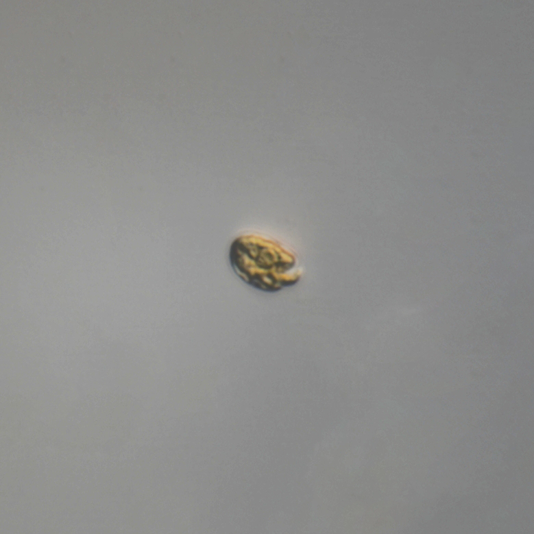 Amphidinium_Small.jpg