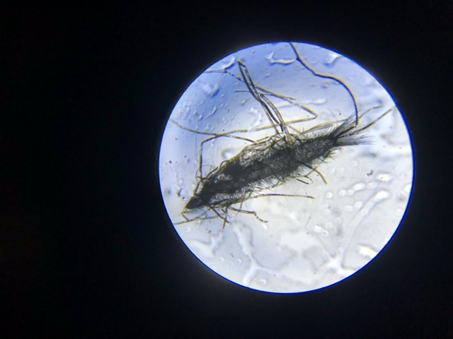Found this micro organism in my refugium. Does anybody know what it is ...