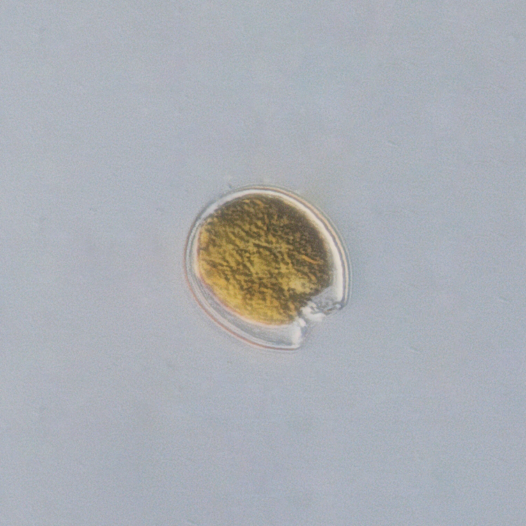 Dehydrated_Benthic_Prorocentrum_2.jpg