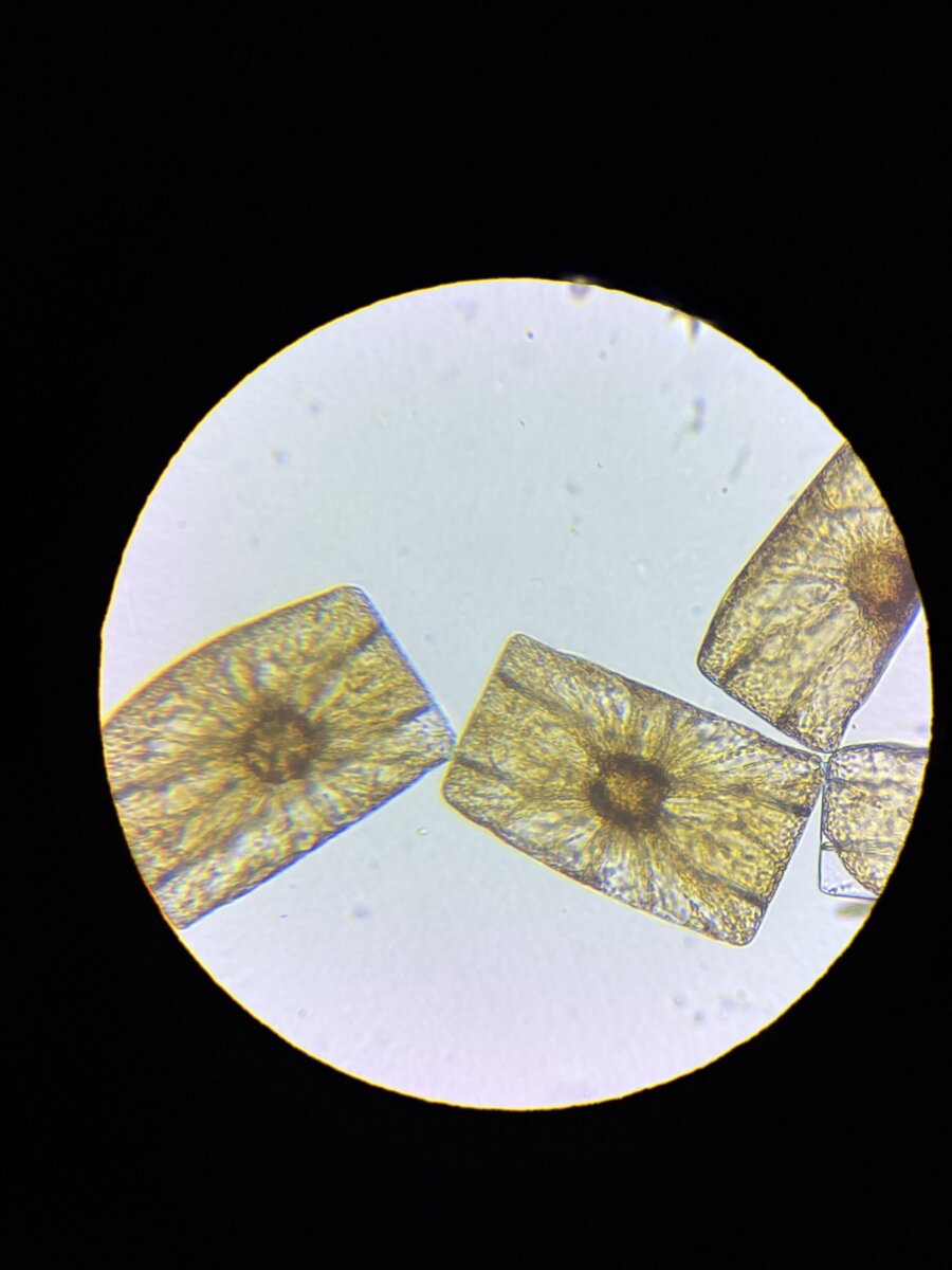 Diatom_striatella unipunctata.jpeg