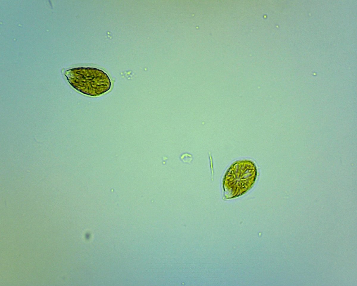 dinoflagellate002.jpg