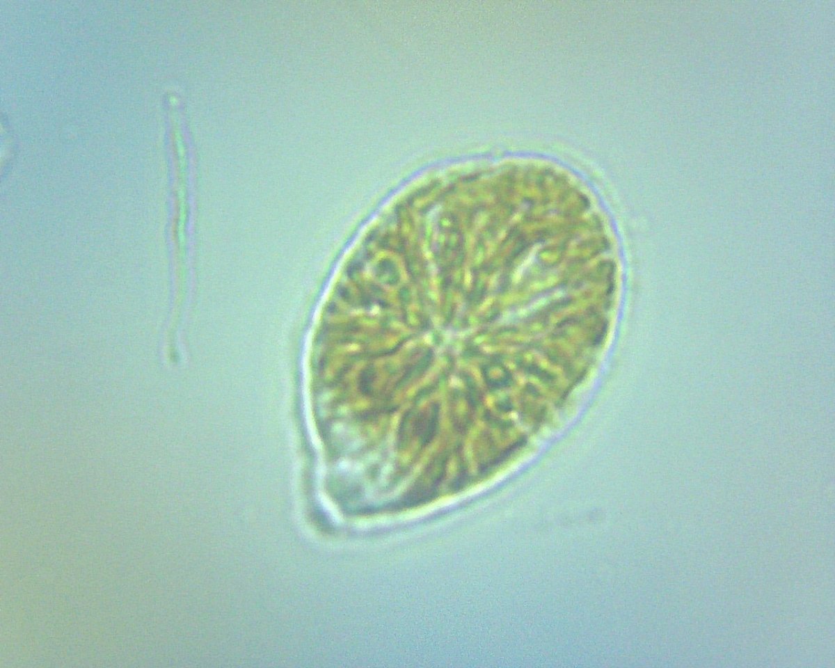 dinoflagellate003.jpg