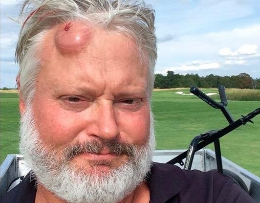 Fore.jpg