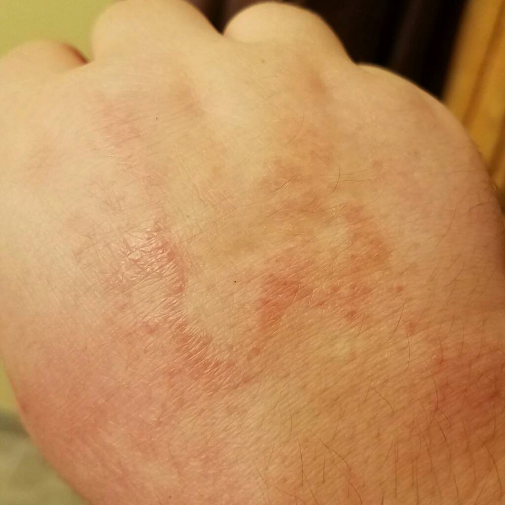 IMG_20170121_224431_341.jpeg