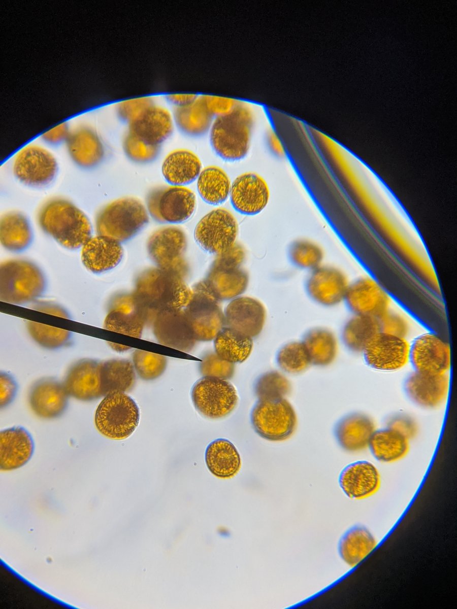 Microscope Bacteria/Algae ID | Reef2Reef