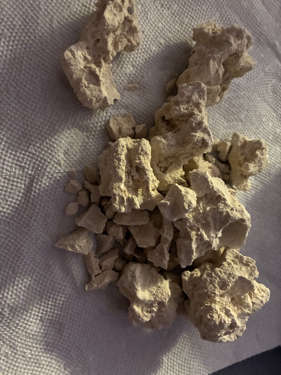 Should I add more rock rubble? If yes, where should I put it (see ...