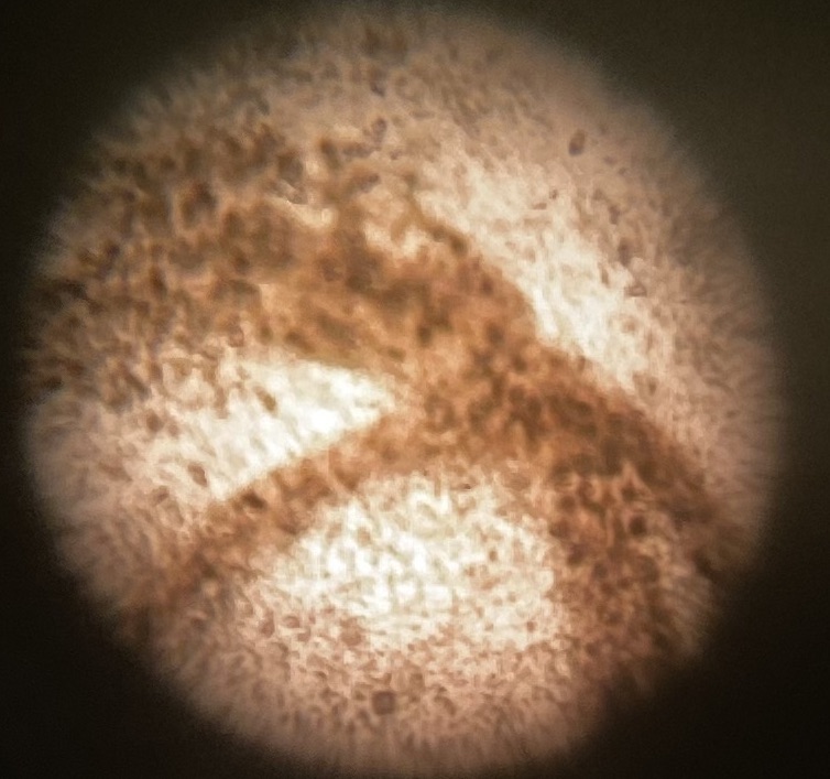 Dino ID w/ microscope | Reef2Reef