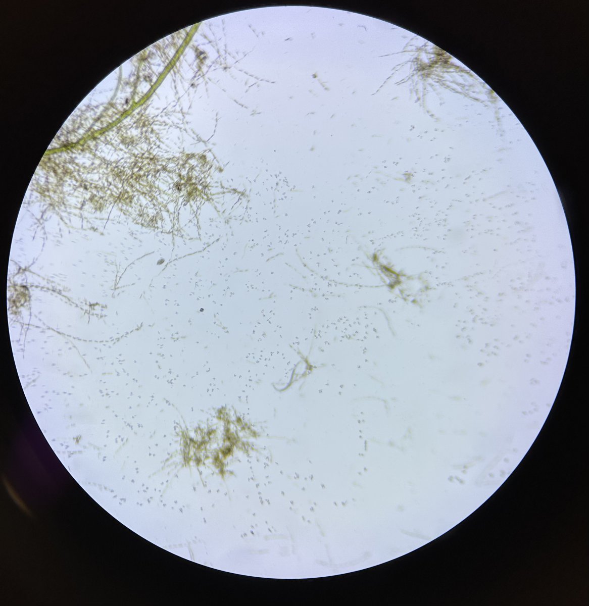 Algae ID Help (with Microscope Pics) | Reef2Reef