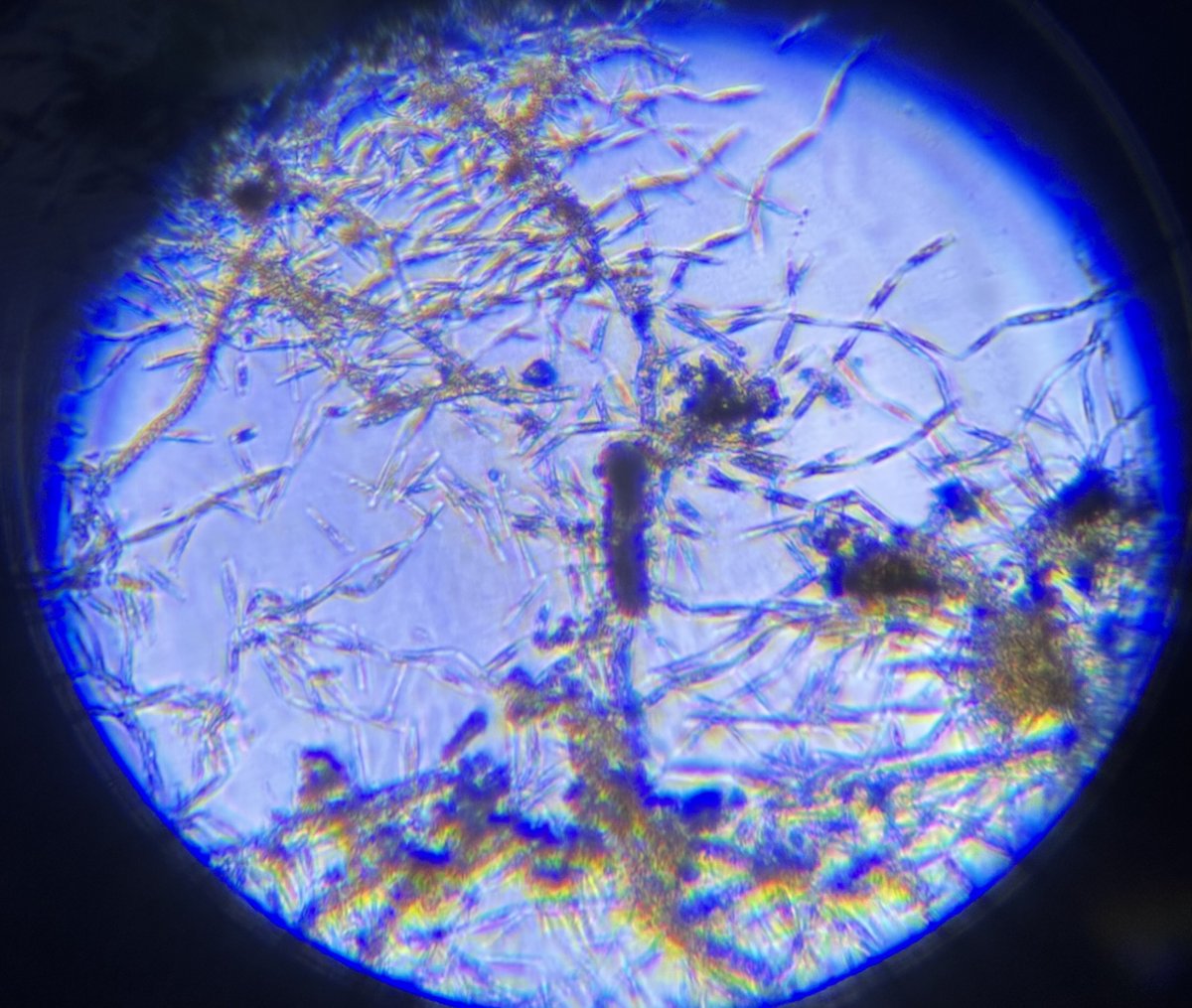 Diatoms or Cyano? | Reef2Reef