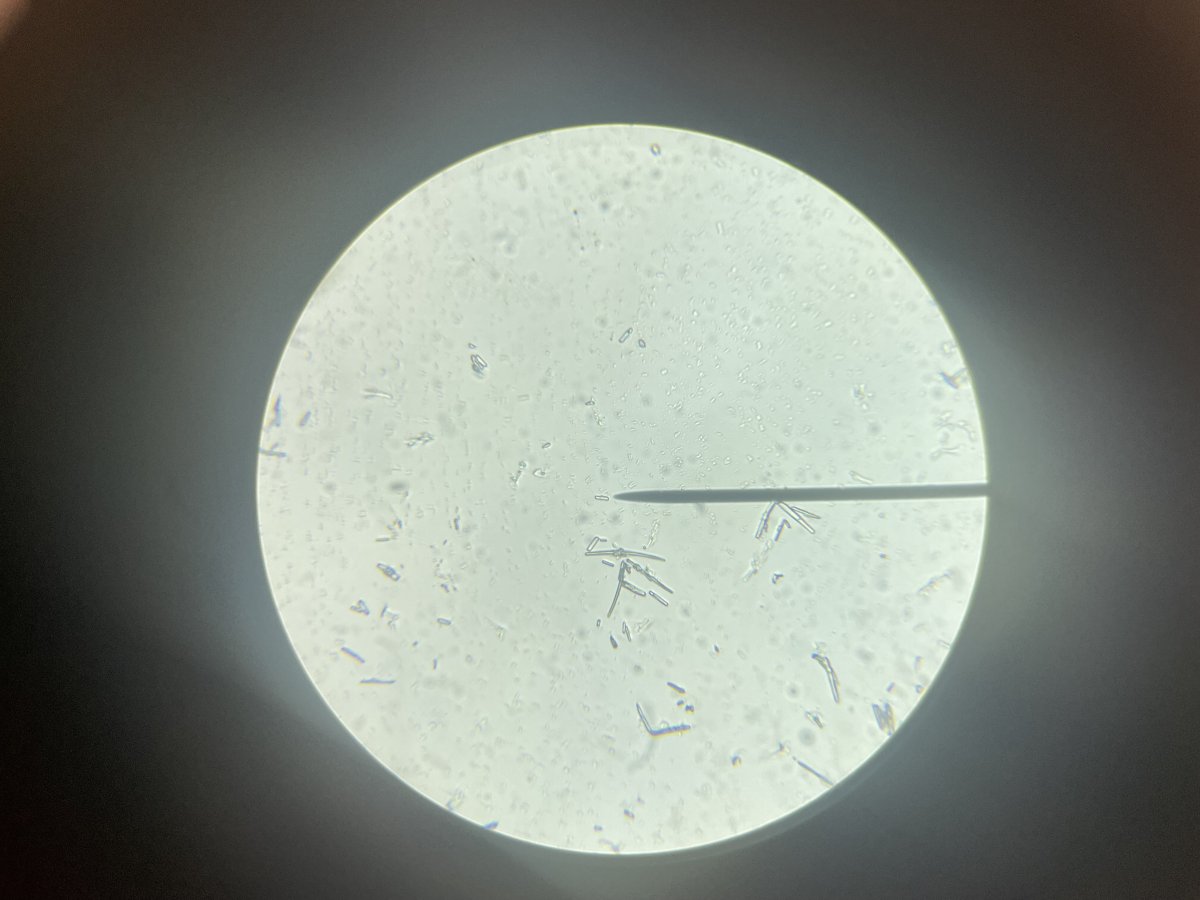 Microscope photos of Brown Slime, Help ID and treatment recommendations ...