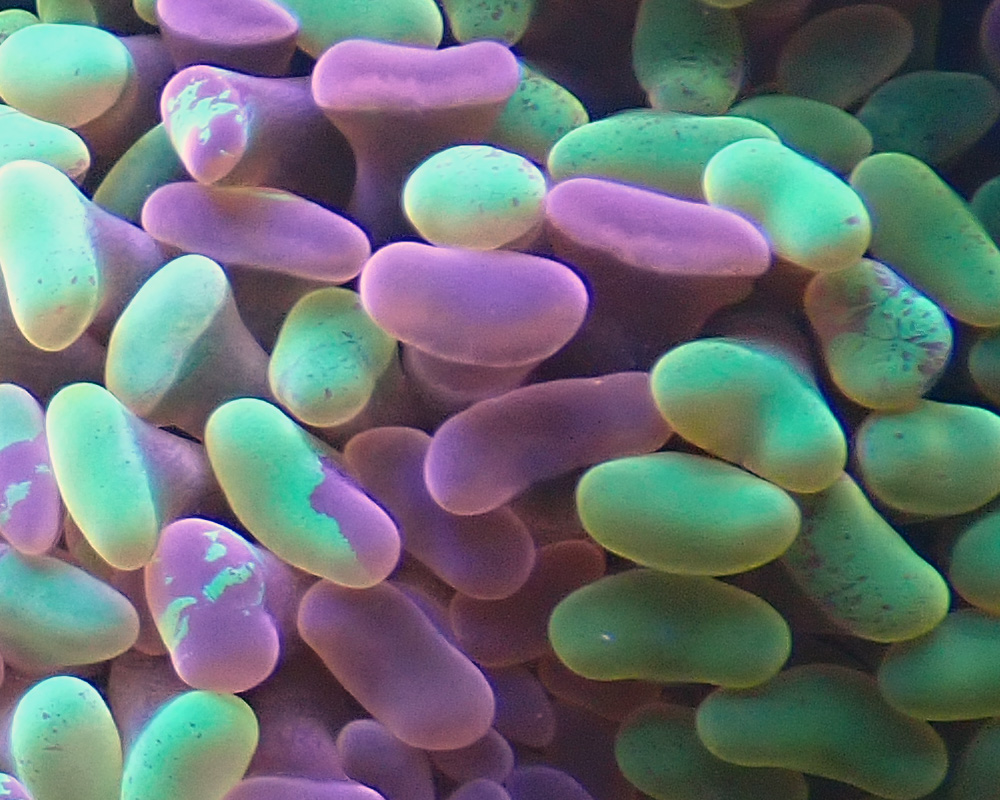 polyps2.jpg
