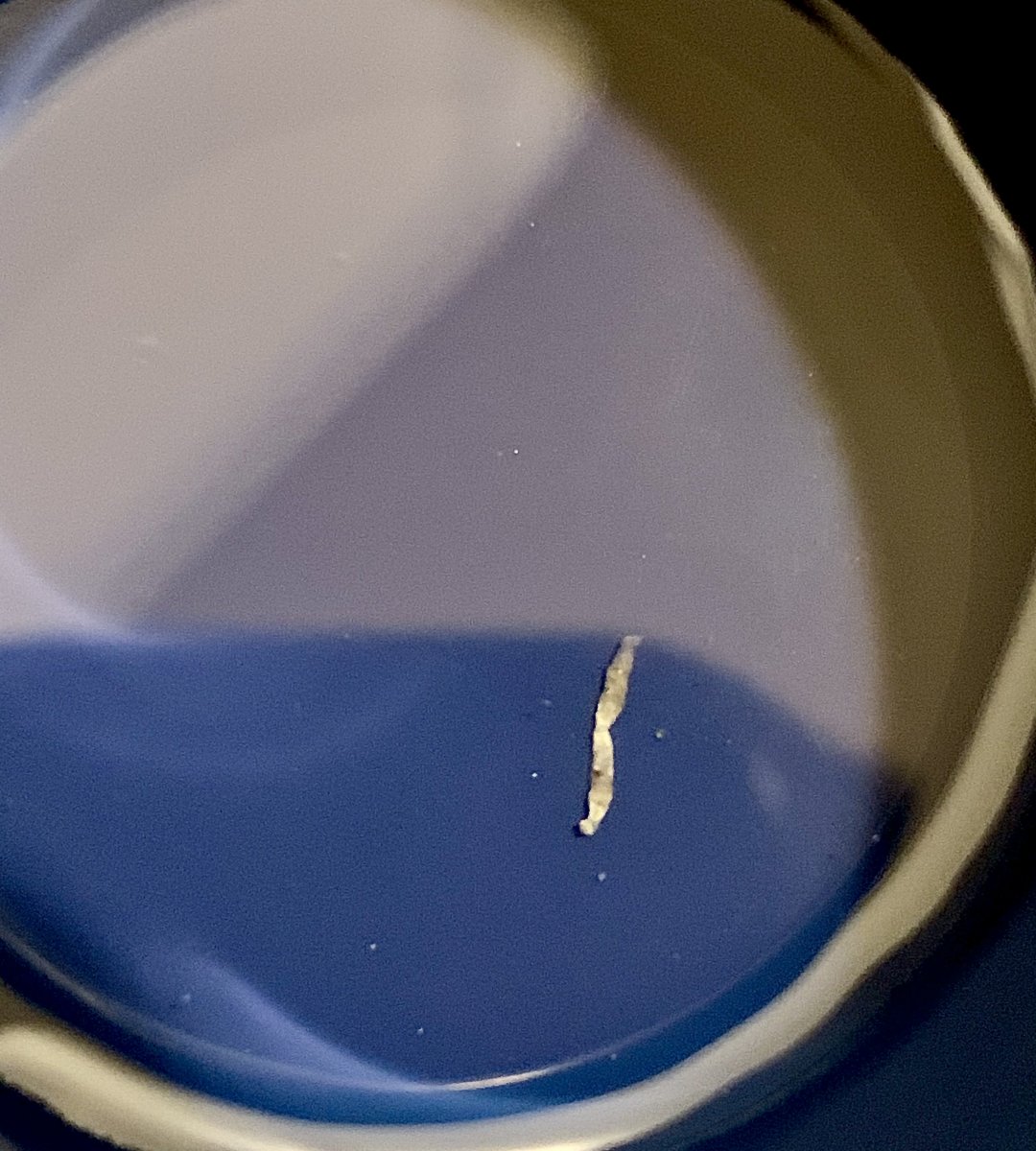 Long Strings In Poop