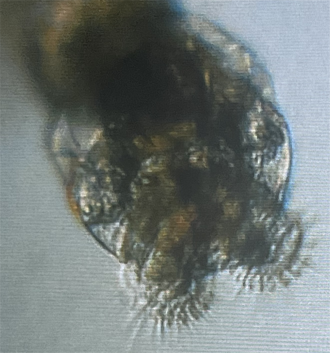 Are Rotifers only for feeding Fry? | Reef2Reef