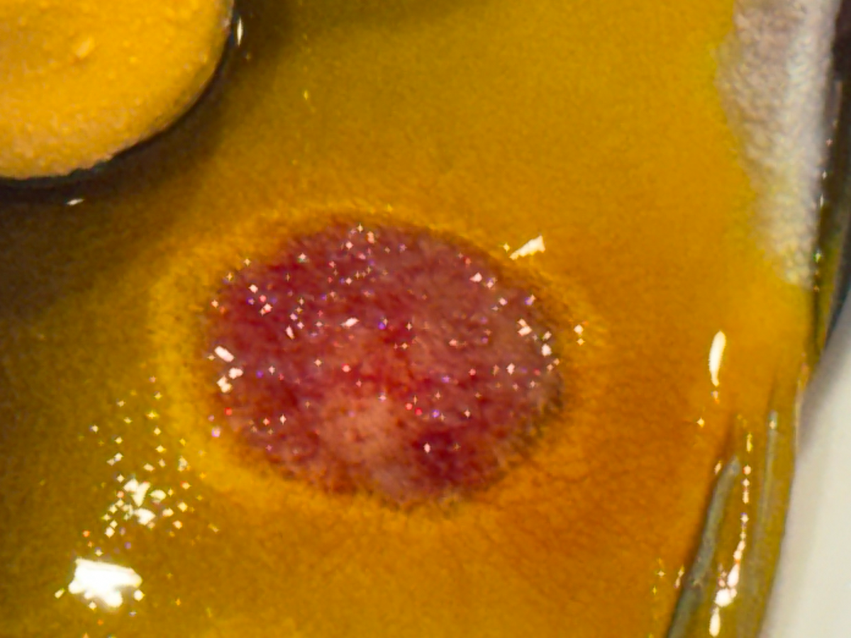 wound-external-4.png