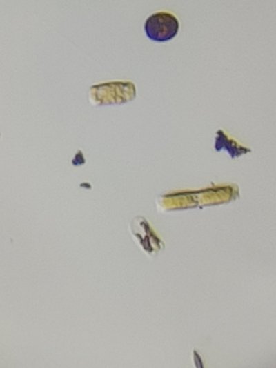 Pennat diatoms.jpg