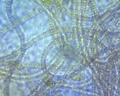 cyanobacteria.png