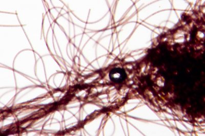 cyano_60X.jpg cyano_60X.jpg