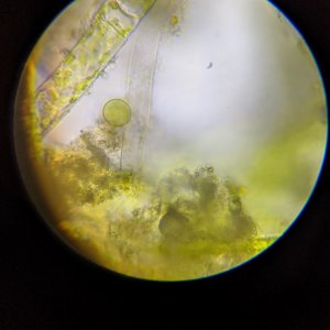 Algae under microscope