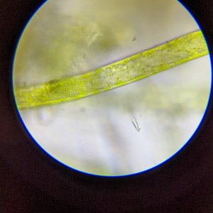 Algae under microscope