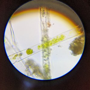 Algae under microscope