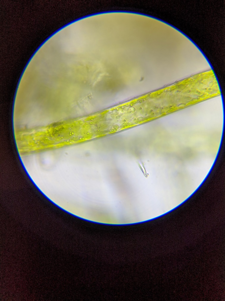 Algae under microscope