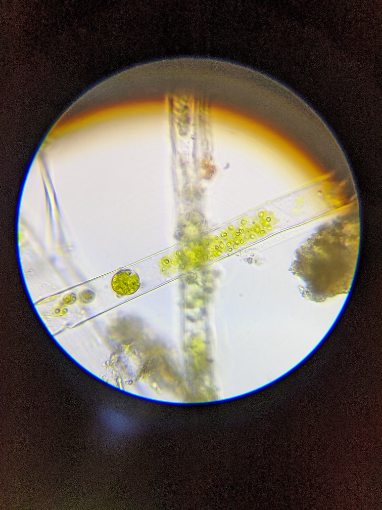 Algae under microscope